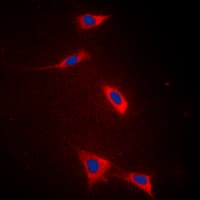 SLC27A5 / BACS Antibody (Internal)