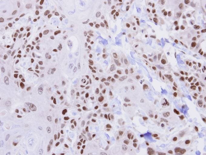 HUS1 Antibody (aa1-273)