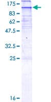 Human HMG-CoA Reductase / HMGCR Protein (Recombinant GST)