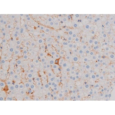 AKT1 Antibody (phospho-Ser124)