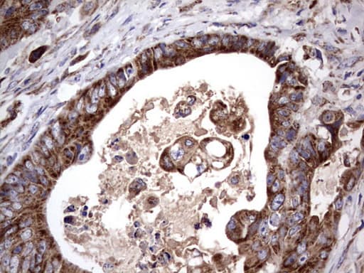 Monoclonal Mouse anti-Human ACE2 / ACE-2 Antibody (clone OTI4D2, aa18-237, IHC, WB)