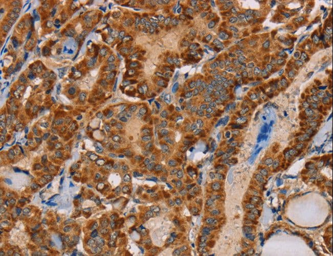 MBNL3 Antibody