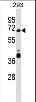 ZNF79 Antibody (aa43-70)
