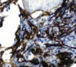 Monoclonal Mouse anti-Human NGFR / CD271 / TNR16 Antibody (IHC)
