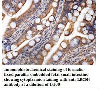 Polyclonal Rabbit anti-Human LRCH4 Antibody (aa119-299, IHC, WB)