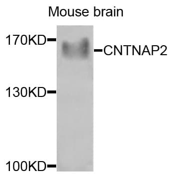 Polyclonal Rabbit anti-Human CNTNAP2 / CASPR2 Antibody (IHC, WB)