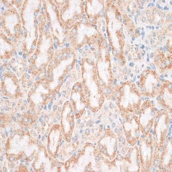 HMGIY / HMGA1 Antibody