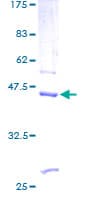 Human REG1B Protein (Recombinant GST)