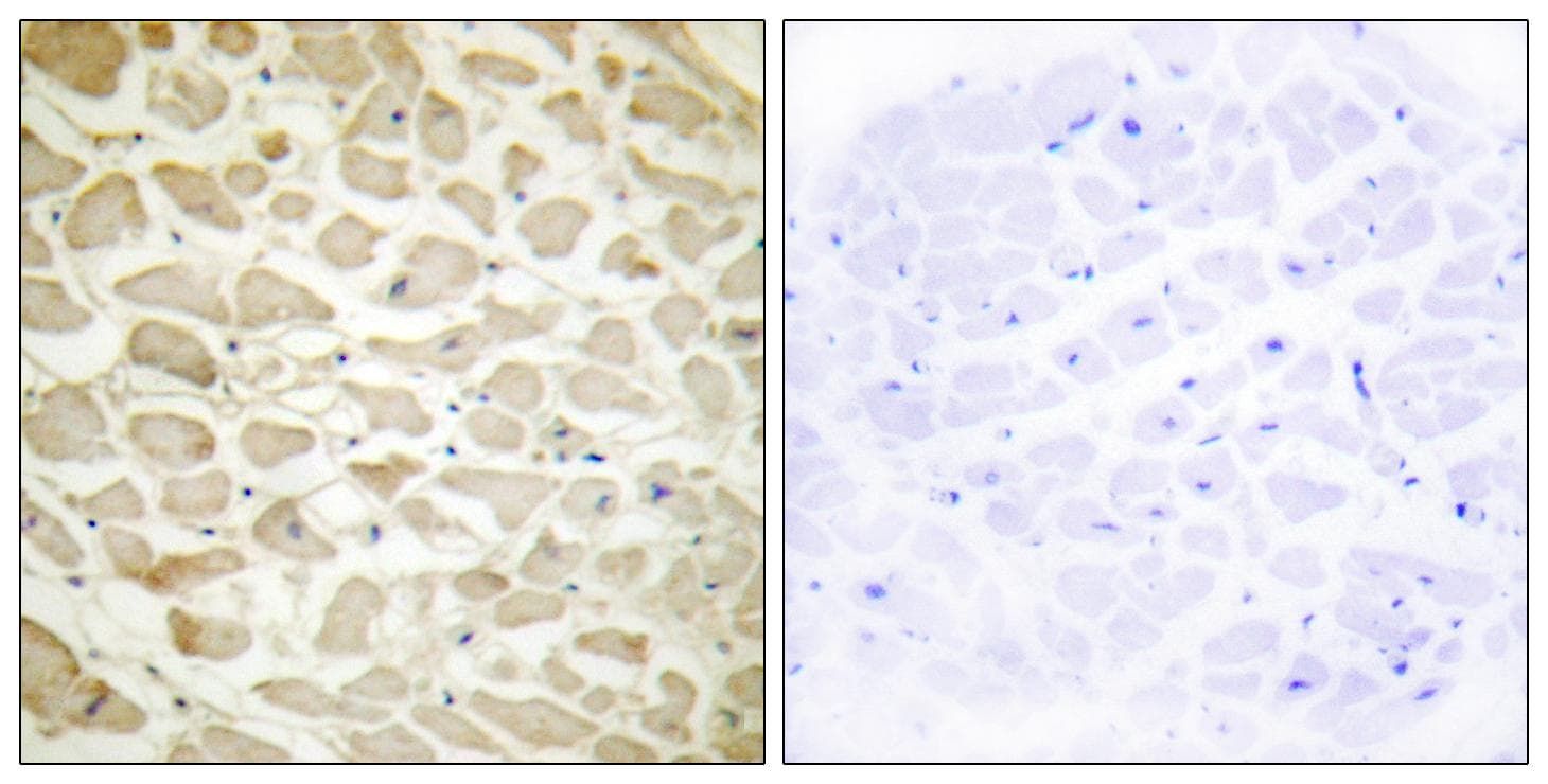 COL14A1 / Collagen XIV Antibody