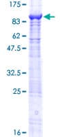 Human TCHHL1 Protein (Recombinant GST)
