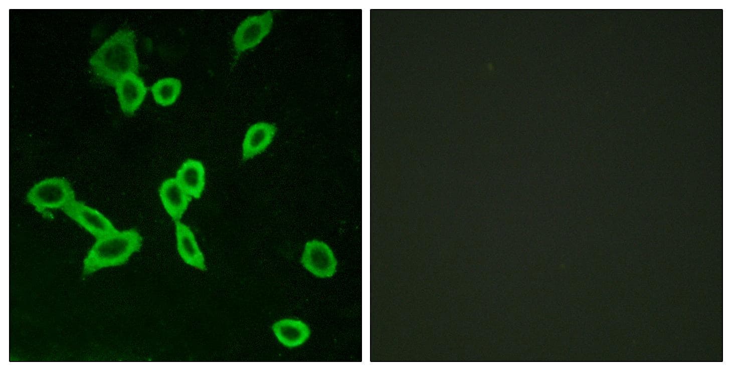 Polyclonal Rabbit anti-Human LGR6 Antibody (IF, WB)