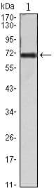 FAK / Focal Adhesion Kinase Antibody (clone 10H7E9)