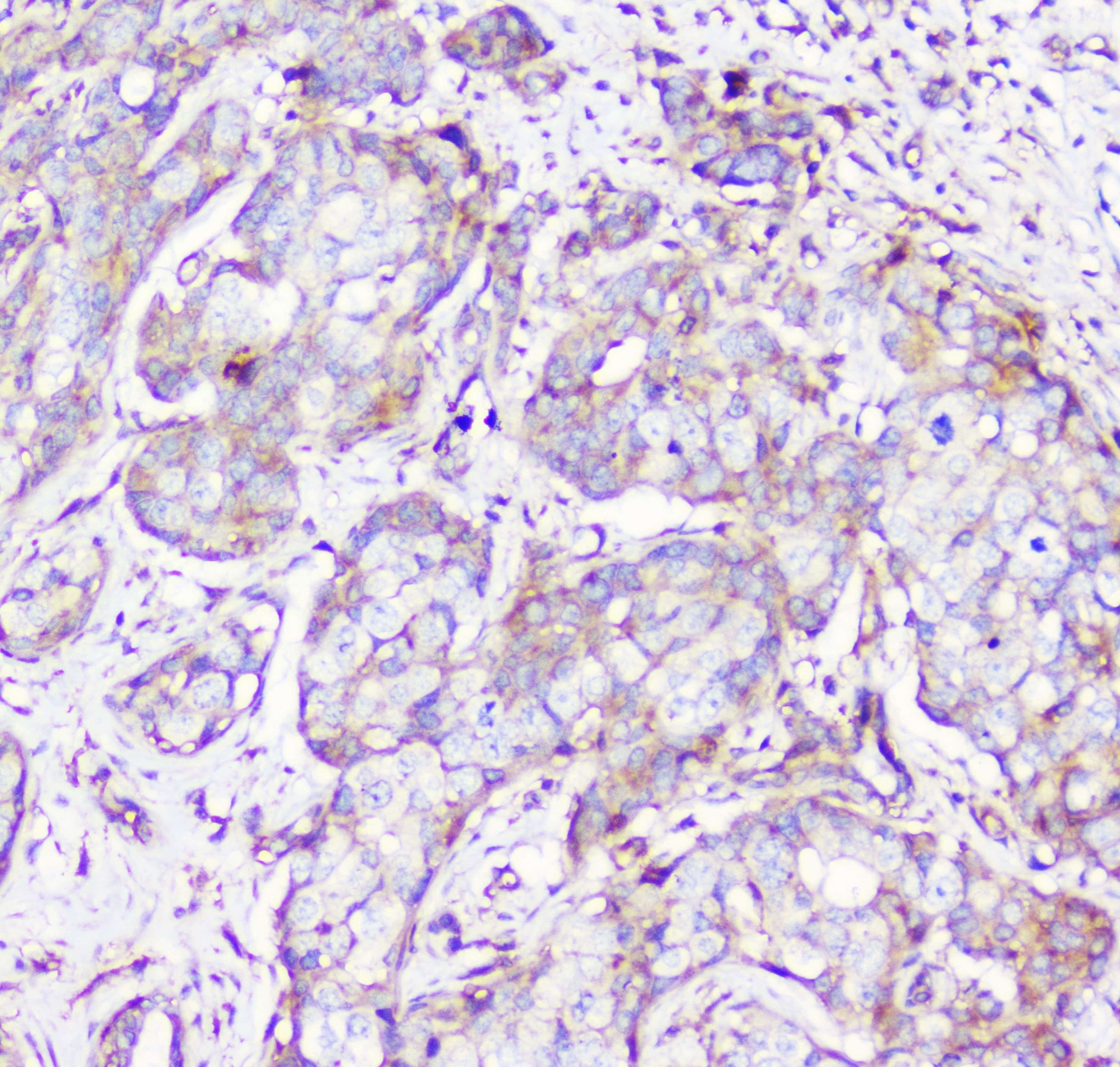 Polyclonal Rabbit anti-Human RP2 Antibody (IHC, WB)