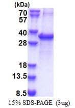 Human ACOT11 / THEA Protein (Recombinant His)
