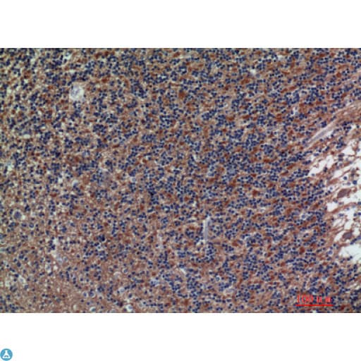 NCAM / CD56 Antibody