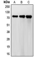 FSH Receptor / FSHR Antibody (Internal)
