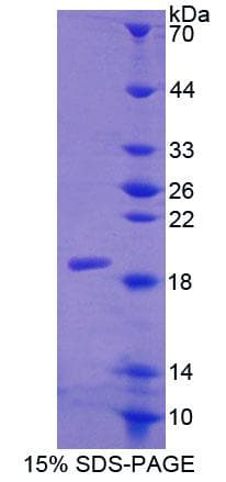 Mouse CALCR / Calcitonin Receptor Protein (Recombinant His-T7)