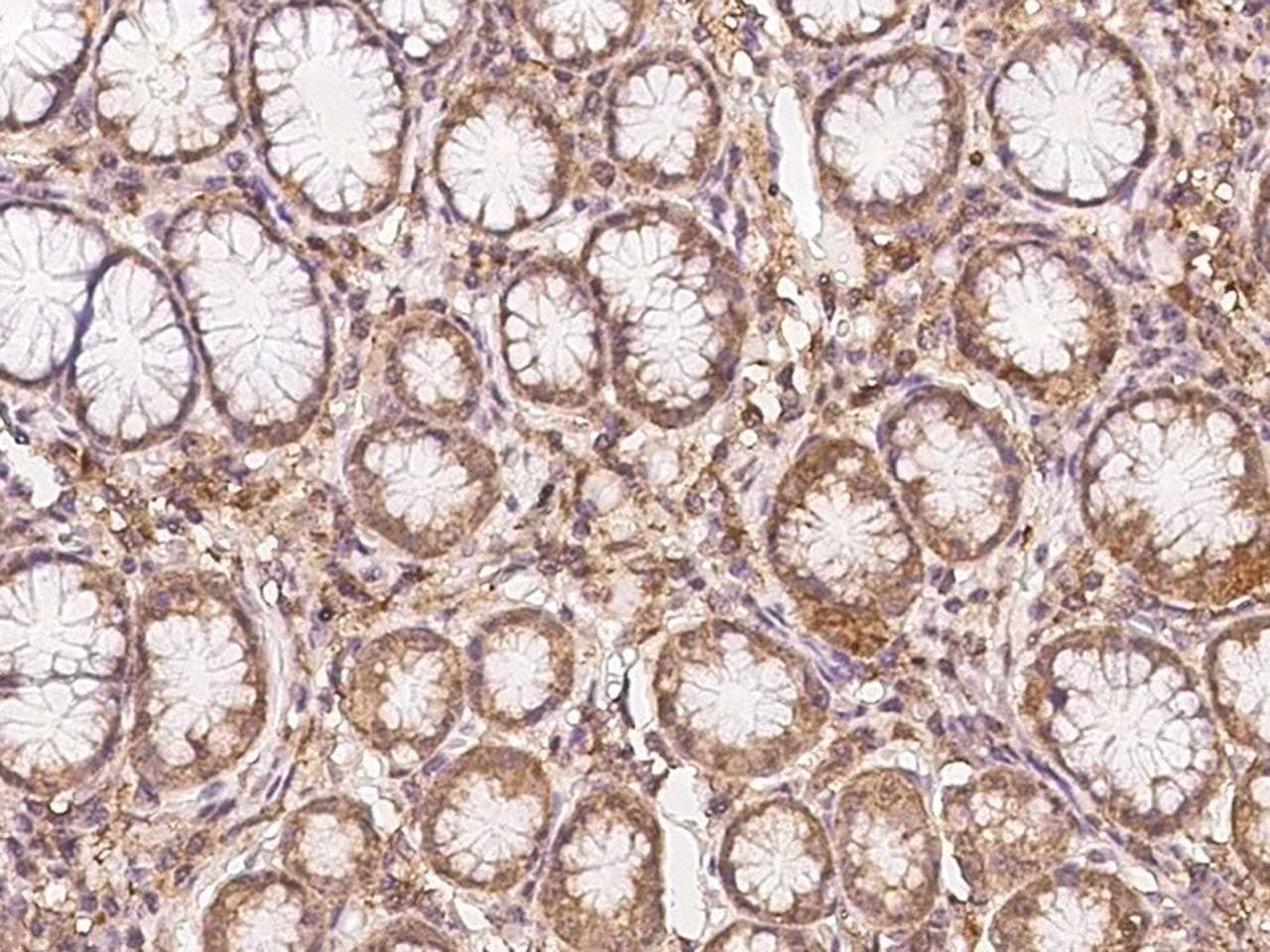 KANK1 Antibody
