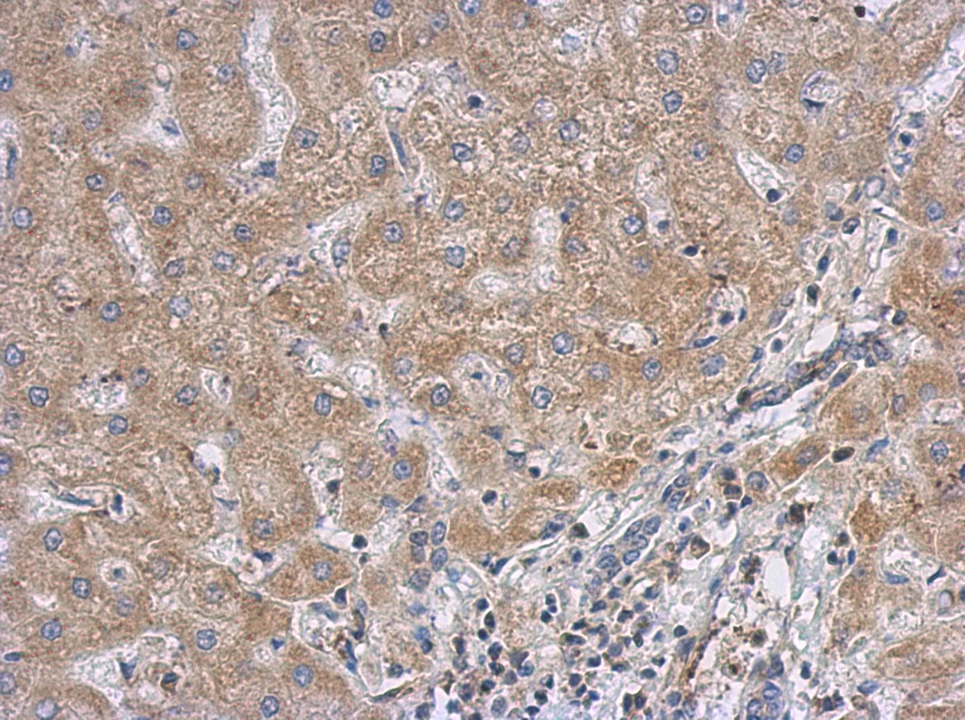 RACGAP1 / MGCRACGAP Antibody (aa1-202)