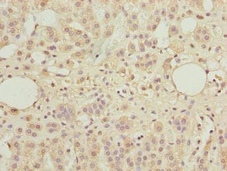 TBC1D14 Antibody
