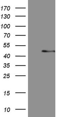 MSTN / GDF8 / Myostatin Antibody (aa24-266, clone OTI2D10)