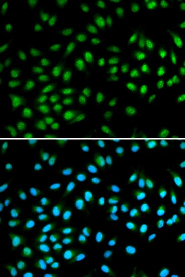 BCL2 / Bcl-2 Antibody