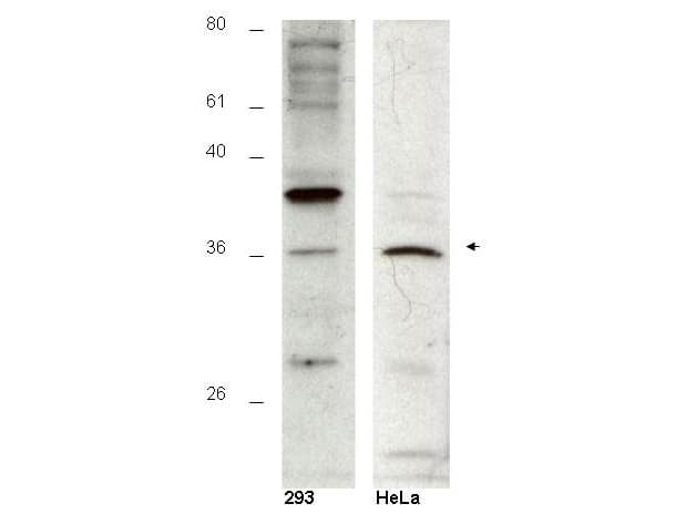 IHC-plus™ Polyclonal Rabbit anti-Human HUS1B Antibody (IHC, WB)