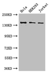 ATXN2 / SCA2 / Ataxin-2 Antibody