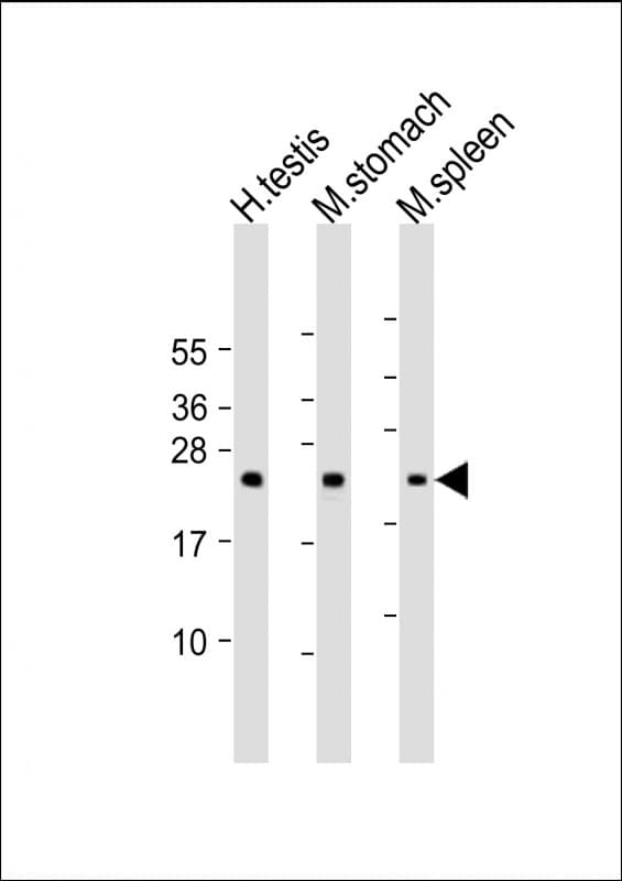 NAA40 Antibody (C-Terminus)