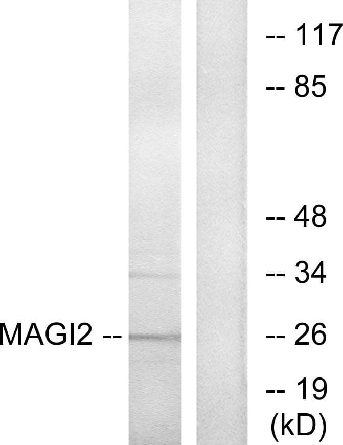 MAGI2 / AIP-1 Antibody