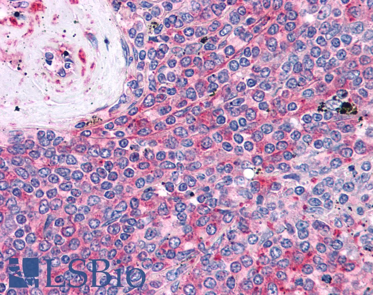 IHC-plus™ LST1 Antibody (clone LST1/02)