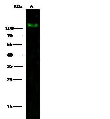 Monoclonal Mouse anti-Human PDGFRA / PDGFR Alpha Antibody (clone 6C7E2, Preservative Free, WB)