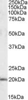 U2AF1L4 Antibody (aa82-94)