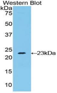 RAD54L2 Antibody (aa638-837)