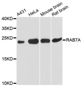 Polyclonal Rabbit anti-Human RAB7A / RAB7 Antibody (WB)