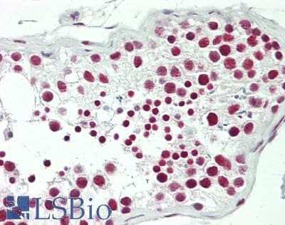 IHC-plus™ Polyclonal Rabbit anti-Human RANBP3 Antibody (aa150-200, IHC, IF, WB)