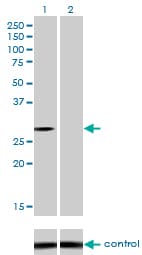 NQO1 Antibody (clone 1E3-A6)