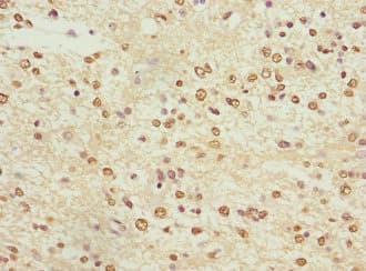 KCNA3 / Kv1.3 Antibody