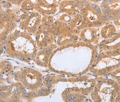 Polyclonal Rabbit anti-Human LAMP3 / CD208 Antibody (IHC, WB)