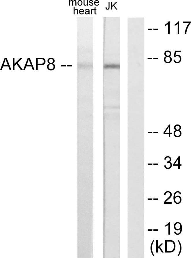 IHC-plus™ AKAP8 / AKAP95 Antibody (aa331-380)