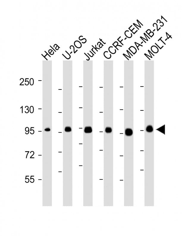 Monoclonal Mouse anti-Human RANBPM Antibody (clone 1815CT202.22.8.37, IHC, WB)
