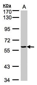 YARS / Tyrosyl-tRNA Synthetase Antibody