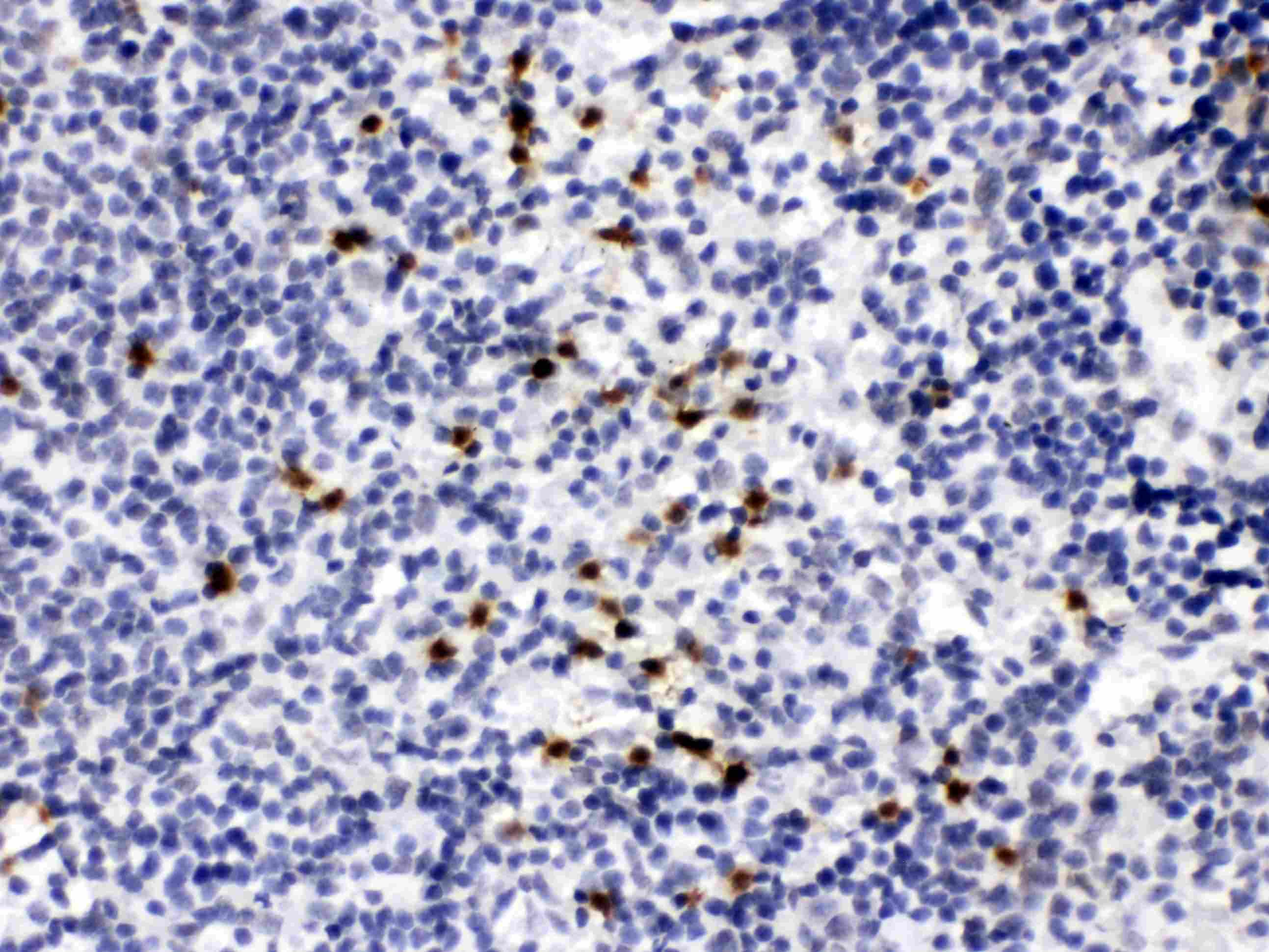 MMP9 / Gelatinase B Antibody
