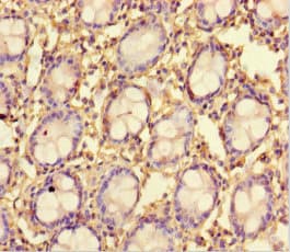 Polyclonal Rabbit anti-Human TMPRSS7 Antibody