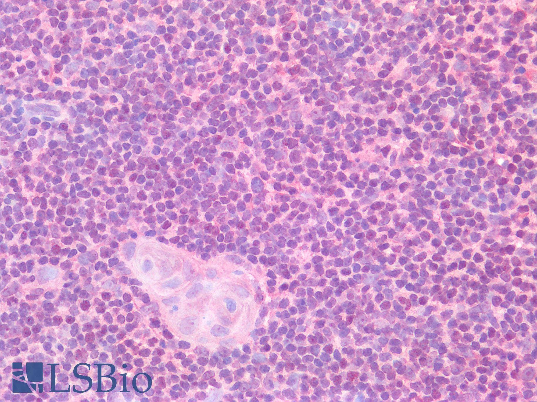 IHC-plus™ FOXC1 Antibody