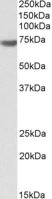 IHC-plus™ Polyclonal Goat anti-Human BAG3 / BAG-3 Antibody (aa537-548, IHC, WB)