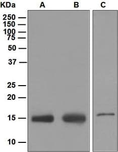 IHC-plus™ Fragilis / IFITM3 Antibody (Internal, clone EPR5242)