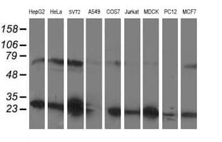 PGAM2 Antibody (clone OTI2F5)