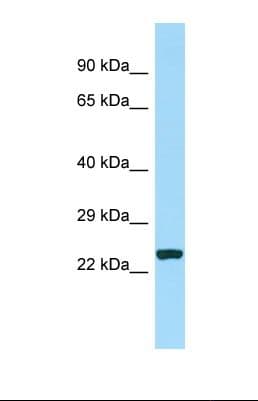 CDCA7 Antibody (aa58-107)