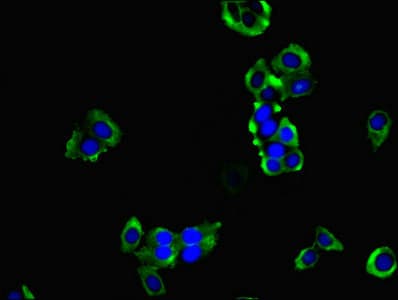 HPCAL1 / Hippocalcin-Like 1 Antibody